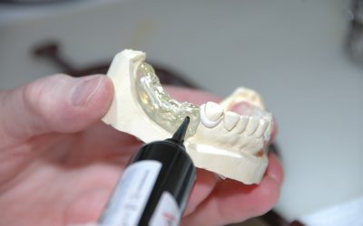 Wat is een tandprotheticus?